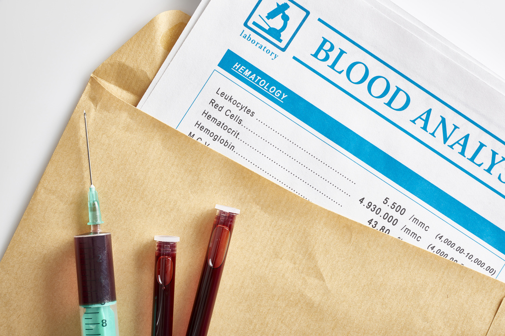 Unprotected database exposes private data of over 800,000 Singaporean blood donors Unprotected database exposes private data of over 800,000 Singaporean blood donors
